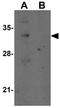 Receptor Accessory Protein 2 antibody, GTX31981, GeneTex, Western Blot image 