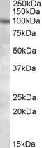 Protein Kinase D2 antibody, orb20333, Biorbyt, Western Blot image 