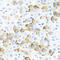 Coagulation Factor III, Tissue Factor antibody, LS-C335155, Lifespan Biosciences, Immunohistochemistry paraffin image 