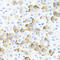 Tissue factor antibody, LS-C335155, Lifespan Biosciences, Immunohistochemistry paraffin image 