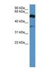 Fascin Actin-Bundling Protein 2, Retinal antibody, NBP1-79776, Novus Biologicals, Western Blot image 