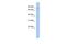 Macrophage Expressed 1 antibody, A11803, Boster Biological Technology, Western Blot image 