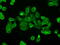 Cytochrome P450 Oxidoreductase antibody, GTX83858, GeneTex, Immunofluorescence image 