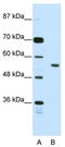 Bromodomain Containing 3 antibody, TA343672, Origene, Western Blot image 