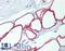 Perilipin 1 antibody, LS-C140916, Lifespan Biosciences, Immunohistochemistry paraffin image 