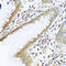 Transmembrane Protein 189 antibody, A14969, Boster Biological Technology, Immunohistochemistry paraffin image 