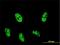 AT-Rich Interaction Domain 4A antibody, H00005926-M01, Novus Biologicals, Immunocytochemistry image 