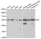 Dihydrolipoamide Dehydrogenase antibody, A5403, ABclonal Technology, Western Blot image 