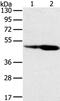 Sorting Nexin 8 antibody, PA5-50792, Invitrogen Antibodies, Western Blot image 