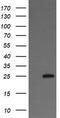 Vesicle Transport Through Interaction With T-SNAREs 1A antibody, TA505824BM, Origene, Western Blot image 