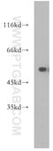 Dual Specificity Phosphatase 10 antibody, 11689-1-AP, Proteintech Group, Western Blot image 