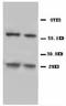 BCL2 Interacting Protein 3 antibody, LS-C171797, Lifespan Biosciences, Western Blot image 