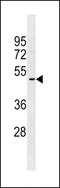 Olfactory Receptor Family 2 Subfamily A Member 5 antibody, 59-933, ProSci, Western Blot image 