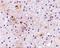 Calcium Dependent Secretion Activator antibody, A05771, Boster Biological Technology, Immunohistochemistry paraffin image 