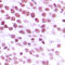 Nibrin antibody, LS-C352568, Lifespan Biosciences, Immunohistochemistry paraffin image 