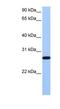 Epithelial Cell Transforming 2 antibody, NBP1-58321, Novus Biologicals, Western Blot image 