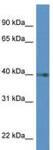 Prostaglandin D2 receptor antibody, TA343146, Origene, Western Blot image 