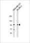 Trichohyalin-like protein 1 antibody, 60-056, ProSci, Western Blot image 