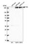 Translocated Promoter Region, Nuclear Basket Protein antibody, NBP1-89452, Novus Biologicals, Western Blot image 