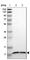 Transmembrane Protein 141 antibody, HPA014615, Atlas Antibodies, Western Blot image 
