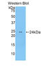 MLC-2 antibody, LS-C302523, Lifespan Biosciences, Western Blot image 