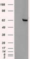 Checkpoint Kinase 2 antibody, TA500385AM, Origene, Western Blot image 