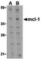 MCL1 Apoptosis Regulator, BCL2 Family Member antibody, PA5-20120, Invitrogen Antibodies, Western Blot image 