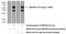 Zinc Finger MYND-Type Containing 8 antibody, 11633-1-AP, Proteintech Group, Western Blot image 