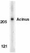 Apoptotic Chromatin Condensation Inducer 1 antibody, GTX27354, GeneTex, Western Blot image 