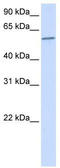 Protein Phosphatase 3 Catalytic Subunit Alpha antibody, TA339197, Origene, Western Blot image 