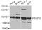 SUZ12 Polycomb Repressive Complex 2 Subunit antibody, A7786, ABclonal Technology, Western Blot image 