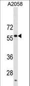 Ubiquitin Specific Peptidase 14 antibody, LS-C157026, Lifespan Biosciences, Western Blot image 