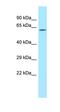 Radixin antibody, orb330857, Biorbyt, Western Blot image 