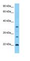 P1 antibody, orb327392, Biorbyt, Western Blot image 