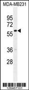 G Protein Nucleolar 3 Like antibody, 55-584, ProSci, Western Blot image 