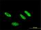 Casein Kinase 2 Alpha 1 antibody, H00001459-M01, Novus Biologicals, Immunocytochemistry image 
