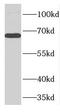 Phenylalanyl-tRNA synthetase beta chain antibody, FNab03015, FineTest, Western Blot image 
