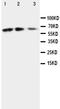 C-X3-C Motif Chemokine Ligand 1 antibody, PA1401, Boster Biological Technology, Western Blot image 