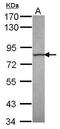 Calpain 13 antibody, GTX118394, GeneTex, Western Blot image 