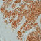 Heat Shock Protein Family B (Small) Member 1 antibody, LS-C87425, Lifespan Biosciences, Immunohistochemistry frozen image 