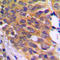 Eukaryotic Elongation Factor 2 Kinase antibody, LS-C354233, Lifespan Biosciences, Immunohistochemistry paraffin image 