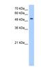 MFNG O-Fucosylpeptide 3-Beta-N-Acetylglucosaminyltransferase antibody, NBP1-79289, Novus Biologicals, Western Blot image 