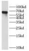Homeobox And Leucine Zipper Encoding antibody, FNab03966, FineTest, Western Blot image 