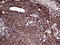 Autophagy Related 4B Cysteine Peptidase antibody, LS-C792376, Lifespan Biosciences, Immunohistochemistry paraffin image 