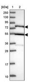 Adaptor Protein, Phosphotyrosine Interacting With PH Domain And Leucine Zipper 2 antibody, PA5-60553, Invitrogen Antibodies, Western Blot image 