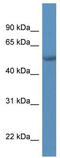 Transcriptional Adaptor 2A antibody, TA334058, Origene, Western Blot image 