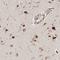 Sushi Domain Containing 6 antibody, NBP1-85931, Novus Biologicals, Immunohistochemistry paraffin image 