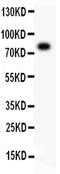 Arachidonate 5-Lipoxygenase antibody, PA5-78762, Invitrogen Antibodies, Western Blot image 