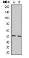 Transducin Beta Like 2 antibody, LS-C368933, Lifespan Biosciences, Western Blot image 