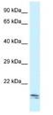 SEC11 Homolog C, Signal Peptidase Complex Subunit antibody, NBP1-79339, Novus Biologicals, Western Blot image 